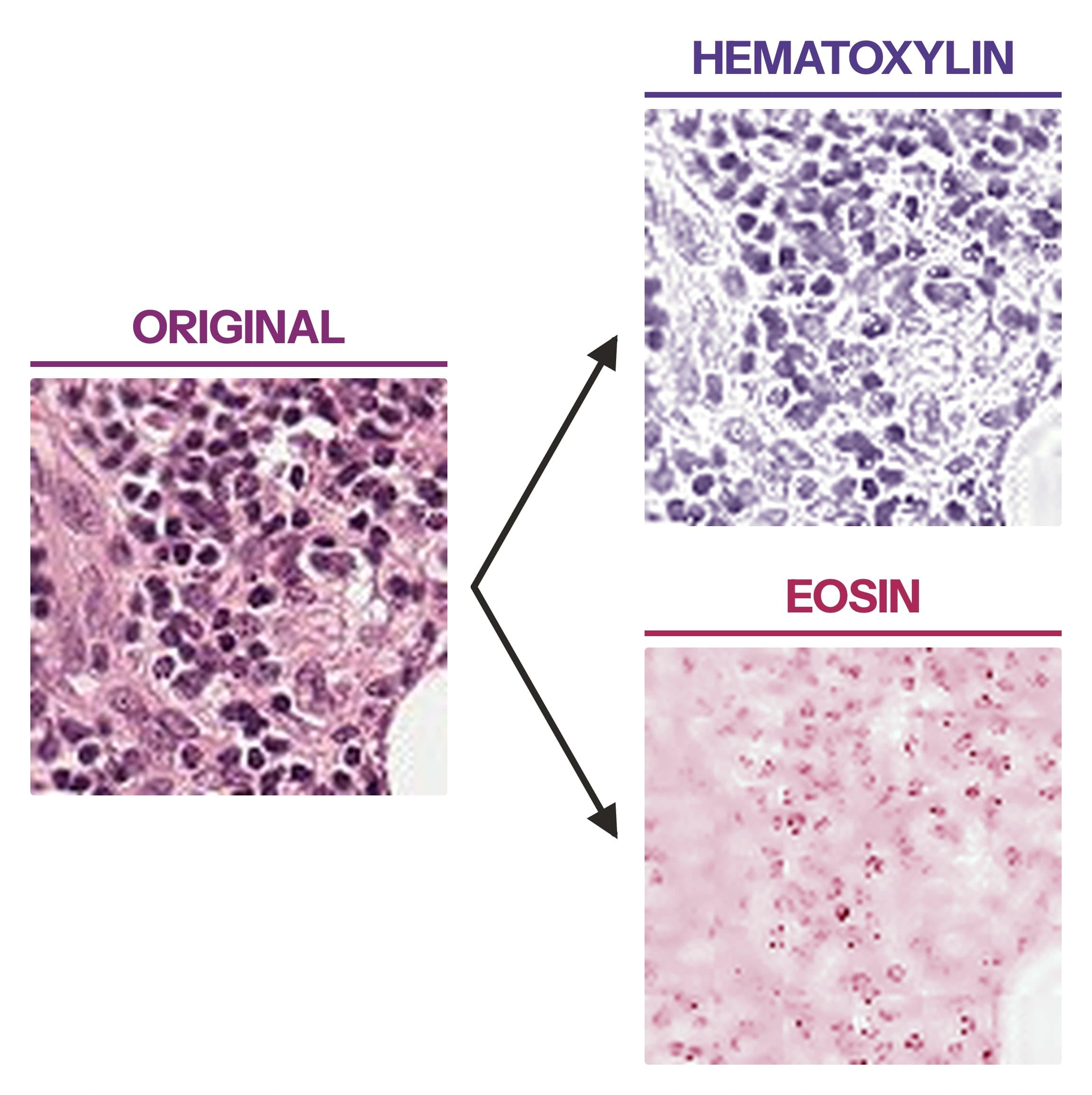 One stained tissue patch with two arrows pointing to its separated channels: a purple hematoxylin channel showing only cell nuclei, and a pink eosin channel showing only cytoplasm and connective tissue.