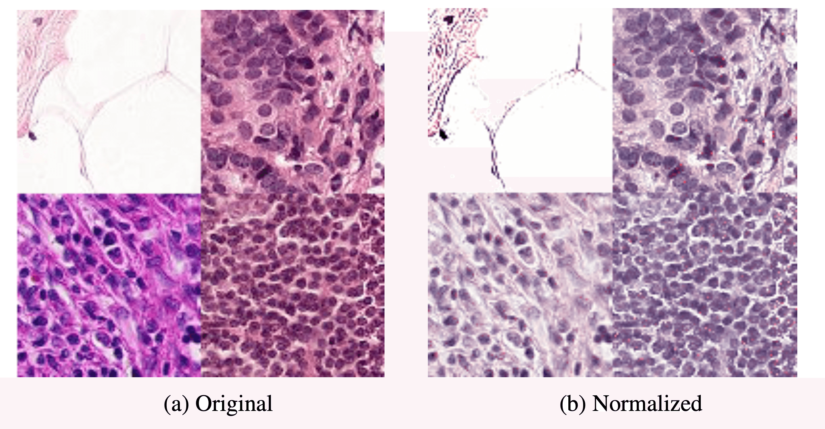 Normalized vs. non-normalized tissue slide pictures